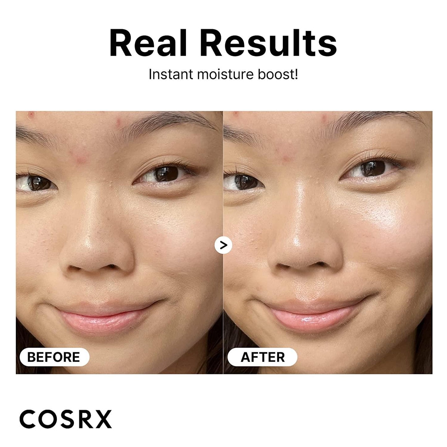 Cosrx |The Hyaluronic Acid - 3 Serum - Kpop store ByHallyuu